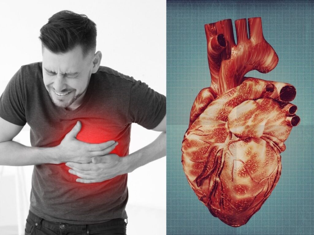 Recognize the Warning Signs of Heart Blockage